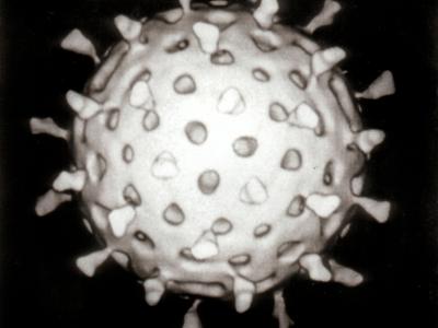 Antichinches Mallorca Schädlingsbekämpfung